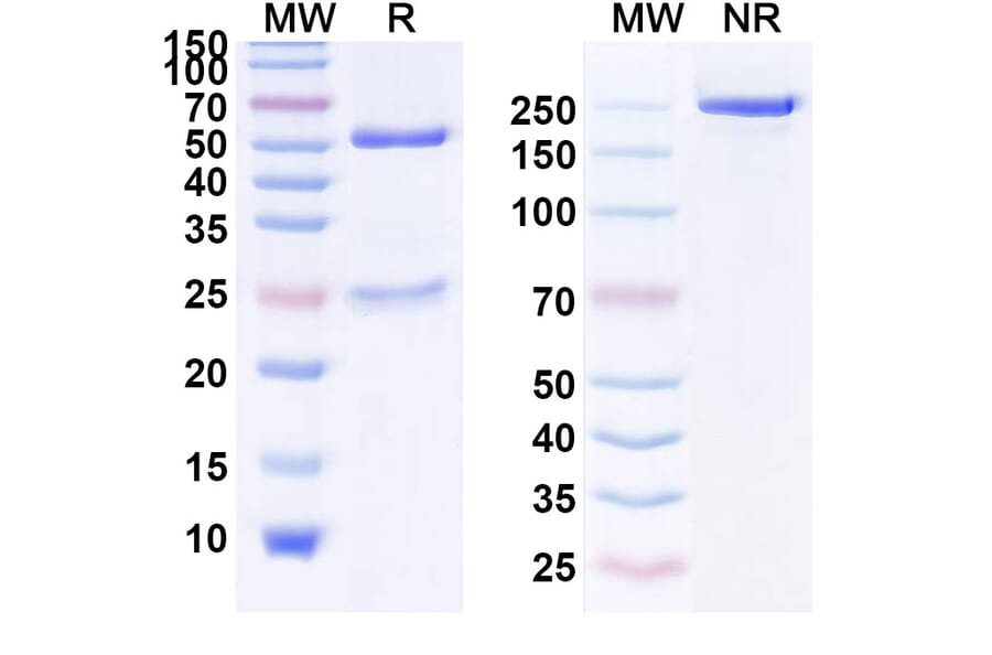 SDS-PAGE - Anti-Human EGFR [CMAB009] Biosimilar - Anti-EGFR Antibody - BSA and Azide free (A339675) - Antibodies.com
