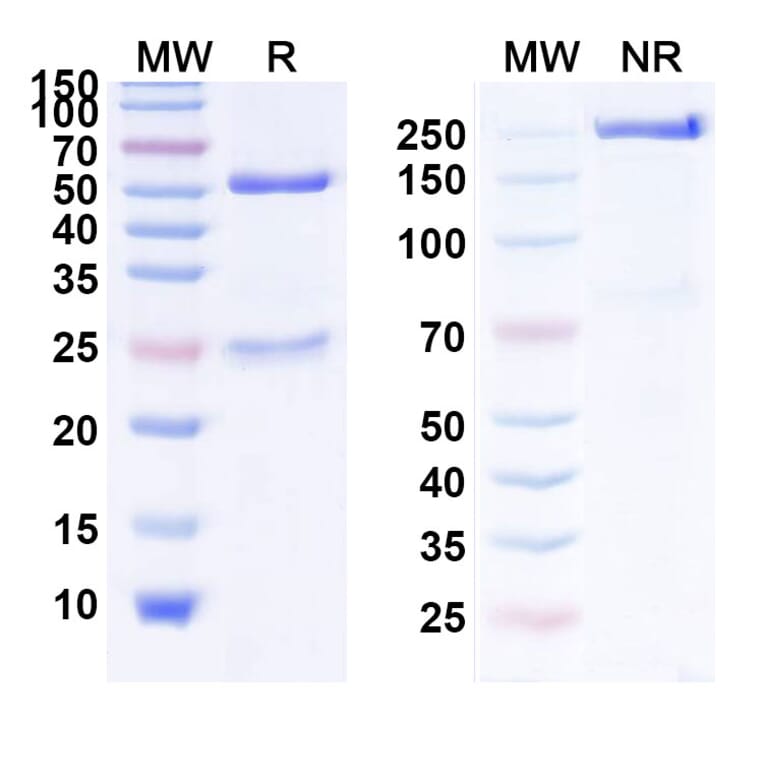 SDS-PAGE - Anti-EGFR Antibody [RC68] Biosimilar - BSA and Azide free (A339678) - Antibodies.com