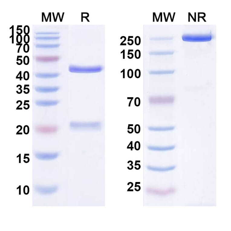 SDS-PAGE - Anti-EGFR Antibody [humMR1] Biosimilar - BSA and Azide free (A339681) - Antibodies.com