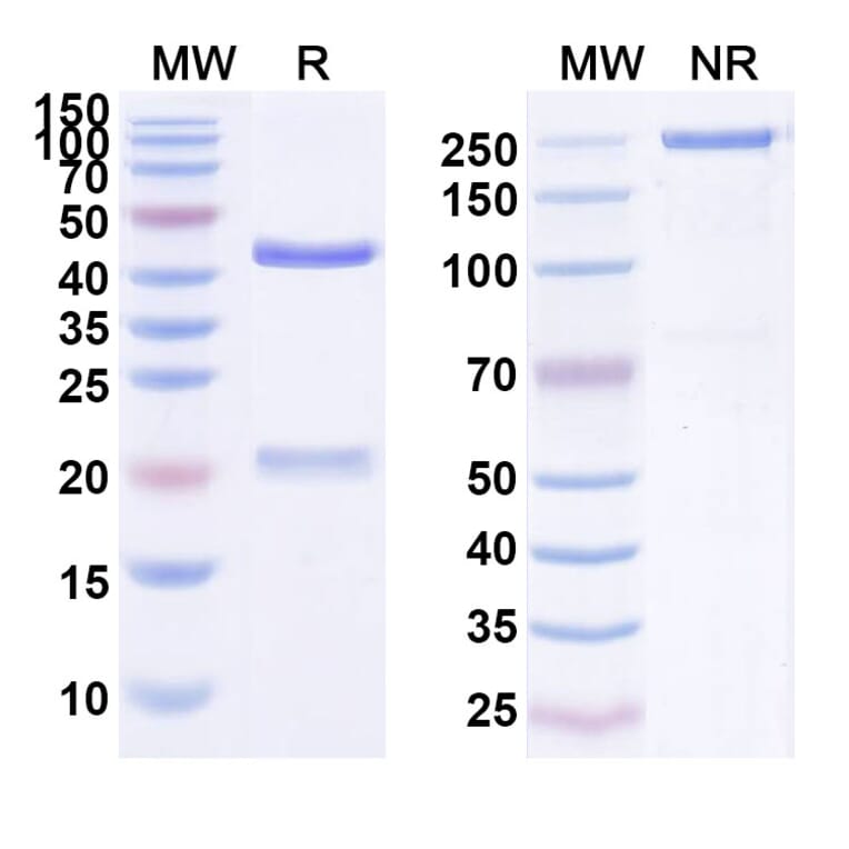 SDS-PAGE - Anti-EGFR Antibody [TAD11] Biosimilar - BSA and Azide free (A339682) - Antibodies.com