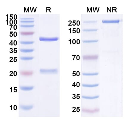 SDS-PAGE - Anti-EMP2 Antibody [PG-11] Biosimilar - BSA and Azide free (A339683) - Antibodies.com