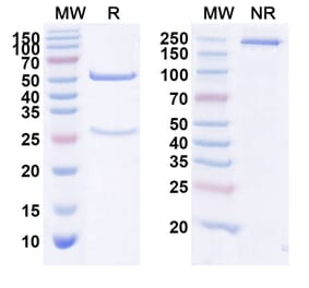 SDS-PAGE - Anti-Estrogen Receptor beta Antibody [MC1] Biosimilar - BSA and Azide free (A339696) - Antibodies.com