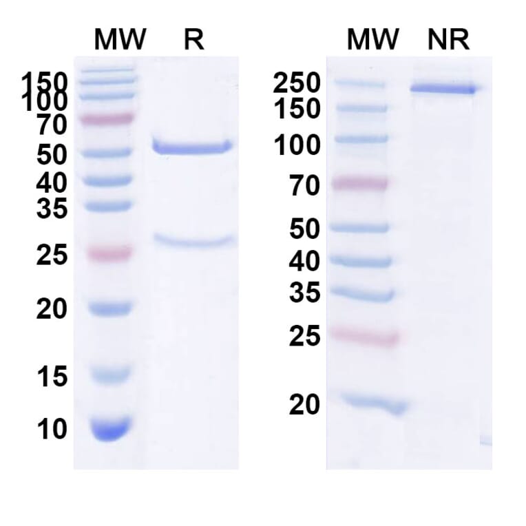 SDS-PAGE - Anti-Factor VIII Antibody [TB-42] Biosimilar - BSA and Azide free (A339697) - Antibodies.com