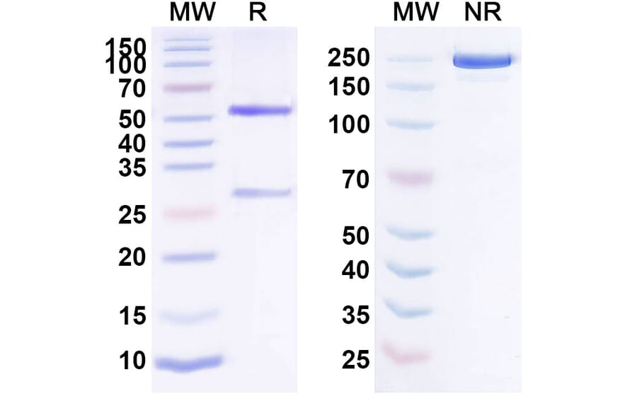 SDS-PAGE - Anti-Factor XI Antibody [REGN9933] Biosimilar - BSA and Azide free (A339700) - Antibodies.com