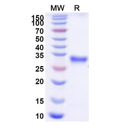 SDS-PAGE - Efgartigimod Biosimilar - Anti-FcRn Antibody - BSA and Azide free (A339704) - Antibodies.com
