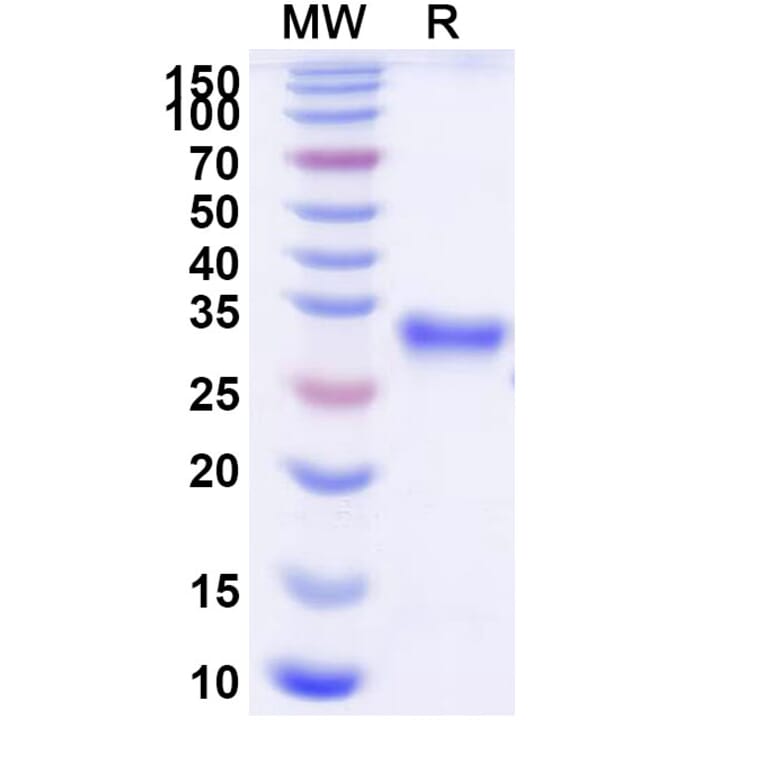 SDS-PAGE - Efgartigimod Biosimilar - Anti-FcRn Antibody - BSA and Azide free (A339704) - Antibodies.com