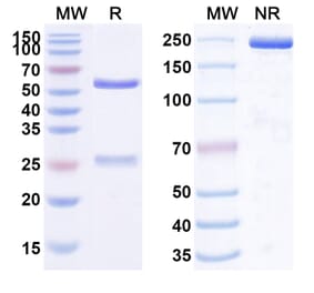 SDS-PAGE - Anti-SLC40A1 Antibody [LY292857] Biosimilar - BSA and Azide free (A339707) - Antibodies.com
