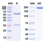SDS-PAGE - Anti-SLC40A1 Antibody [LY292857] Biosimilar - BSA and Azide free (A339707) - Antibodies.com