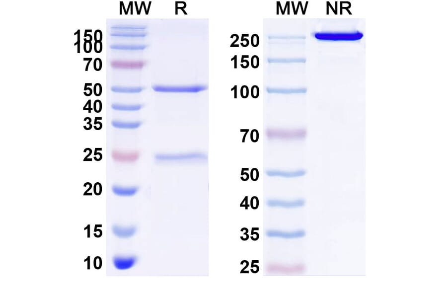SDS-PAGE - Anti-FGFR1 Antibody [OM-RCA-1] Biosimilar - BSA and Azide free (A339712) - Antibodies.com