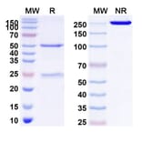 SDS-PAGE - Anti-FGFR1 Antibody [OM-RCA-1] Biosimilar - BSA and Azide free (A339712) - Antibodies.com