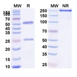 SDS-PAGE - Anti-VEGF Receptor 3 Antibody [LY322856] Biosimilar - BSA and Azide free (A339724) - Antibodies.com