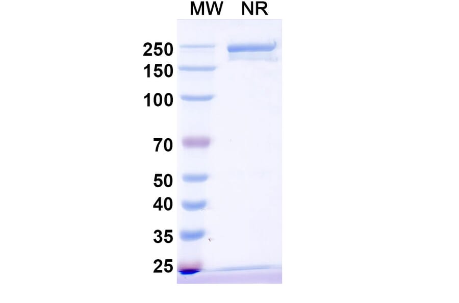SDS-PAGE - Anti-IL-31 Antibody [SAA1416] Biosimilar - BSA and Azide free (A339751) - Antibodies.com