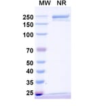 SDS-PAGE - Anti-IL-31 Antibody [SAA1416] Biosimilar - BSA and Azide free (A339751) - Antibodies.com