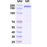 SDS-PAGE - Gilvetmab Biosimilar - Anti-PD-1 Antibody - BSA and Azide free (A339756) - Antibodies.com