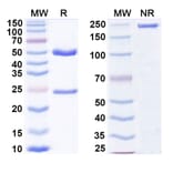 SDS-PAGE - Tirnovetmab Biosimilar - Anti-IL-31 Antibody - BSA and Azide free (A339757) - Antibodies.com