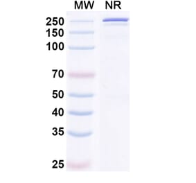 SDS-PAGE - Cirevetmab Biosimilar - Anti-TGF beta 1 Antibody - BSA and Azide free (A339758) - Antibodies.com
