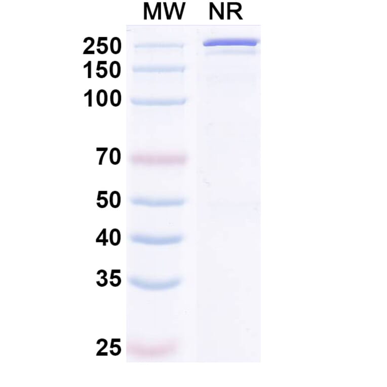 SDS-PAGE - Cirevetmab Biosimilar - Anti-TGF beta 1 Antibody - BSA and Azide free (A339758) - Antibodies.com