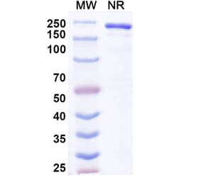 SDS-PAGE - Anvatabart Biosimilar - Anti-ErbB2 Antibody - BSA and Azide free (A339760) - Antibodies.com