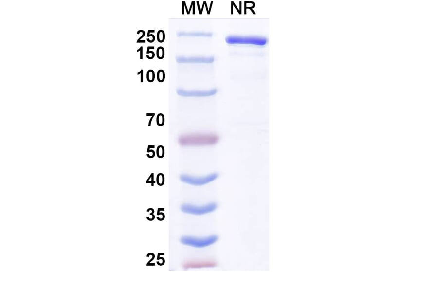 SDS-PAGE - Anvatabart Biosimilar - Anti-ErbB2 Antibody - BSA and Azide free (A339760) - Antibodies.com