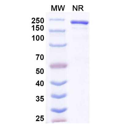 SDS-PAGE - Anvatabart Biosimilar - Anti-ErbB2 Antibody - BSA and Azide free (A339760) - Antibodies.com