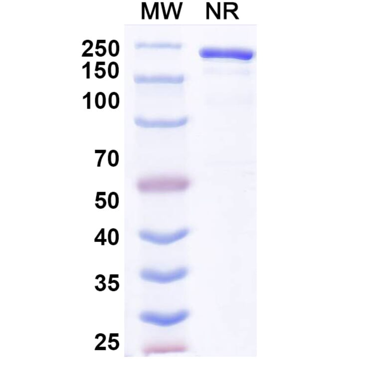SDS-PAGE - Anvatabart Biosimilar - Anti-ErbB2 Antibody - BSA and Azide free (A339760) - Antibodies.com