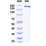SDS-PAGE - Anvatabart Biosimilar - Anti-ErbB2 Antibody - BSA and Azide free (A339760) - Antibodies.com