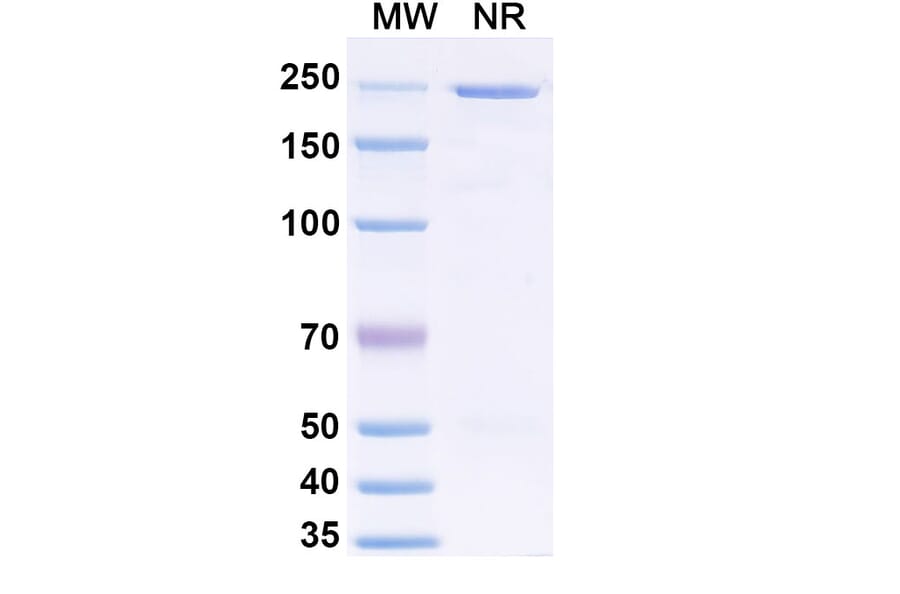 SDS-PAGE - Anvatabart Biosimilar - Anti-ErbB2 Antibody - BSA and Azide free (A339760) - Antibodies.com