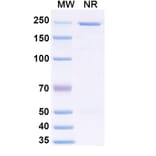 SDS-PAGE - Anvatabart Biosimilar - Anti-ErbB2 Antibody - BSA and Azide free (A339760) - Antibodies.com