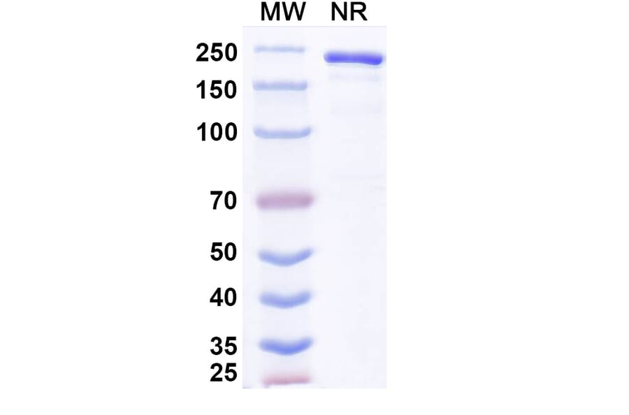 SDS-PAGE - Anvatabart Biosimilar - Anti-ErbB2 Antibody - BSA and Azide free (A339760) - Antibodies.com