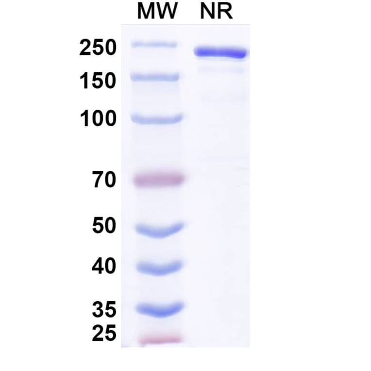 SDS-PAGE - Anvatabart Biosimilar - Anti-ErbB2 Antibody - BSA and Azide free (A339760) - Antibodies.com