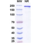 SDS-PAGE - Anvatabart Biosimilar - Anti-ErbB2 Antibody - BSA and Azide free (A339760) - Antibodies.com