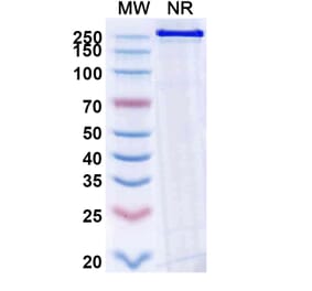 SDS-PAGE - Becotatug Biosimilar - Anti-EGFR Antibody - BSA and Azide free (A339765) - Antibodies.com