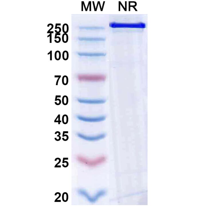 SDS-PAGE - Becotatug Biosimilar - Anti-EGFR Antibody - BSA and Azide free (A339765) - Antibodies.com