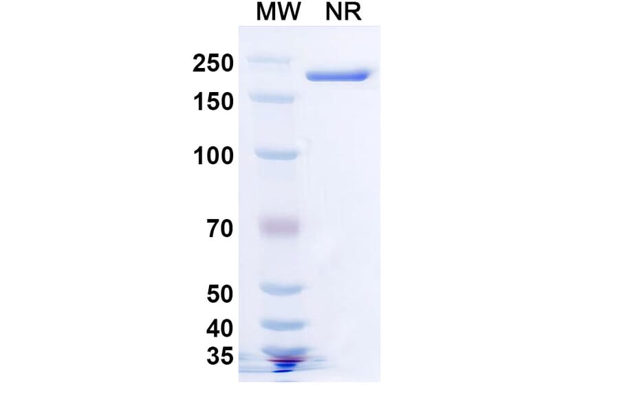SDS-PAGE - Becotatug Biosimilar - Anti-EGFR Antibody - BSA and Azide free (A339765) - Antibodies.com