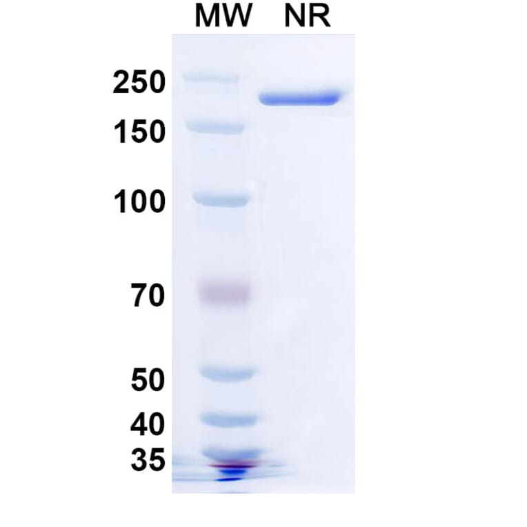 SDS-PAGE - Becotatug Biosimilar - Anti-EGFR Antibody - BSA and Azide free (A339765) - Antibodies.com