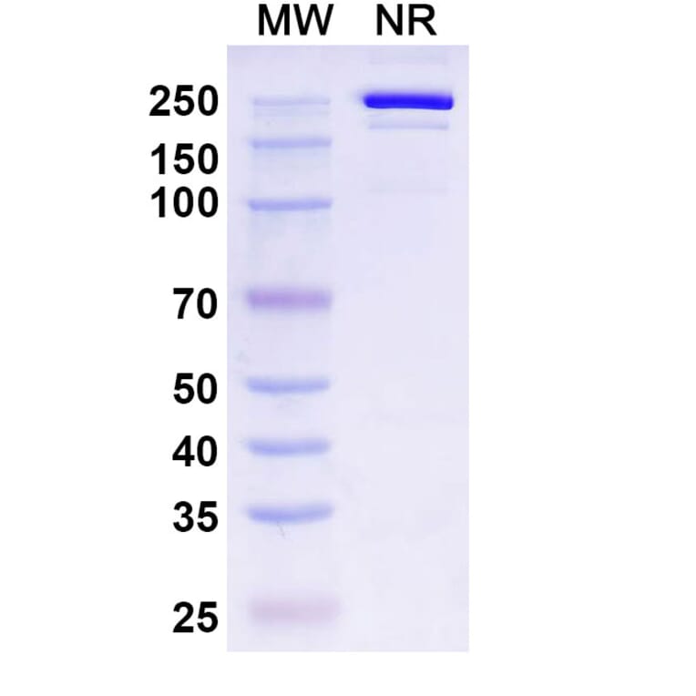 SDS-PAGE - Belrestotug Biosimilar - Anti-TIGIT Antibody - BSA and Azide free (A339766) - Antibodies.com