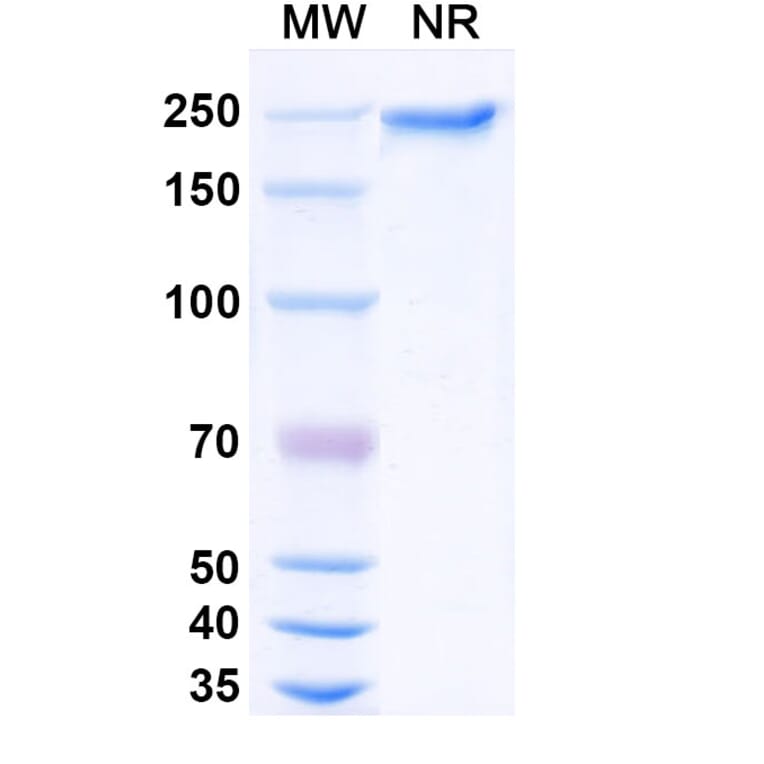 SDS-PAGE - Dargistotug Biosimilar - Anti-TIGIT Antibody - BSA and Azide free (A339767) - Antibodies.com
