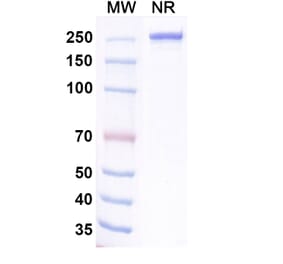 SDS-PAGE - Ralzapastotug Biosimilar - Anti-TIGIT Antibody - BSA and Azide free (A339768) - Antibodies.com