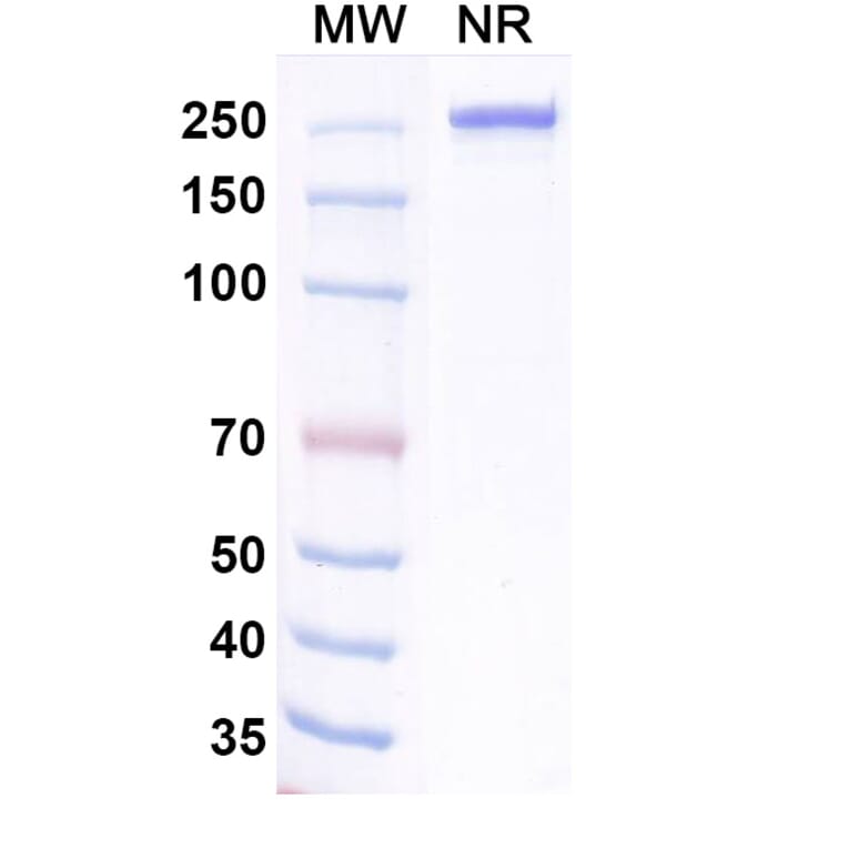 SDS-PAGE - Ralzapastotug Biosimilar - Anti-TIGIT Antibody - BSA and Azide free (A339768) - Antibodies.com