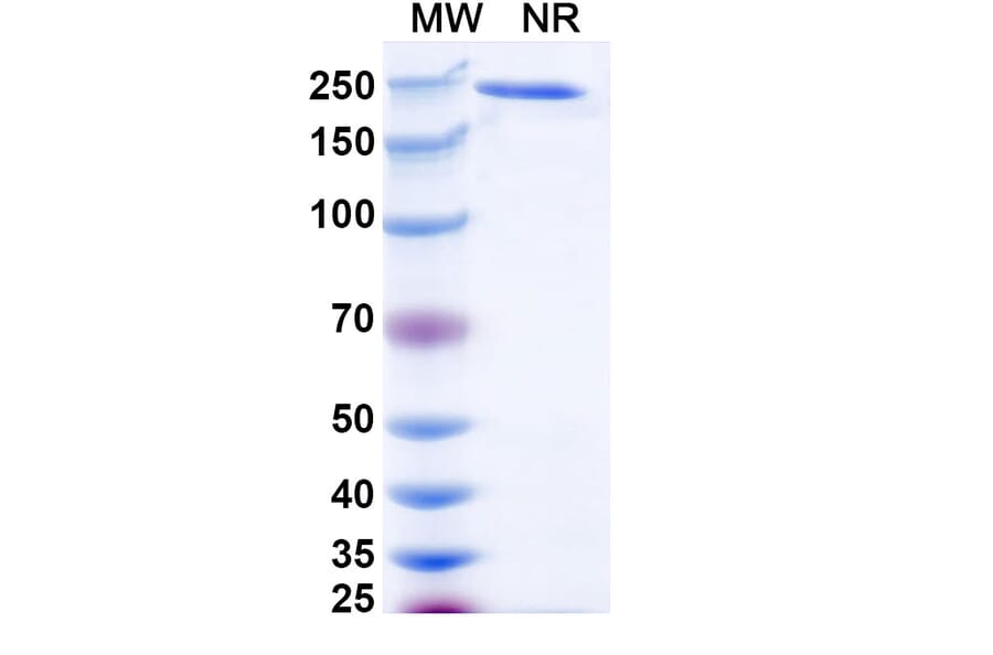 SDS-PAGE - Ralzapastotug Biosimilar - Anti-TIGIT Antibody - BSA and Azide free (A339768) - Antibodies.com
