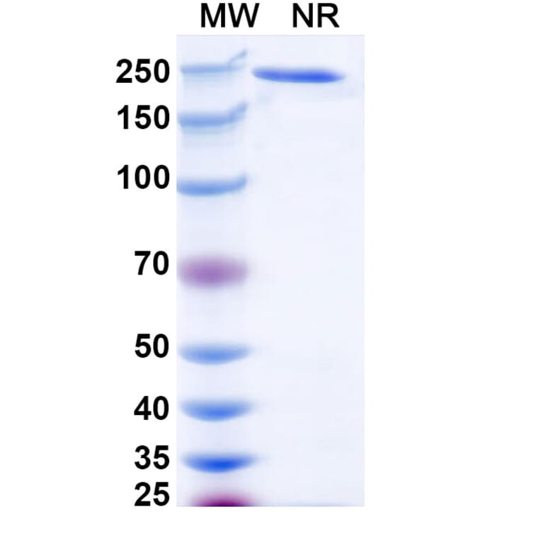 SDS-PAGE - Ralzapastotug Biosimilar - Anti-TIGIT Antibody - BSA and Azide free (A339768) - Antibodies.com
