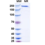 SDS-PAGE - Ralzapastotug Biosimilar - Anti-TIGIT Antibody - BSA and Azide free (A339768) - Antibodies.com