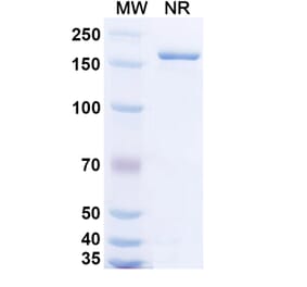 SDS-PAGE - Bempikibart Biosimilar - Anti-CD127 Antibody - BSA and Azide free (A339769) - Antibodies.com