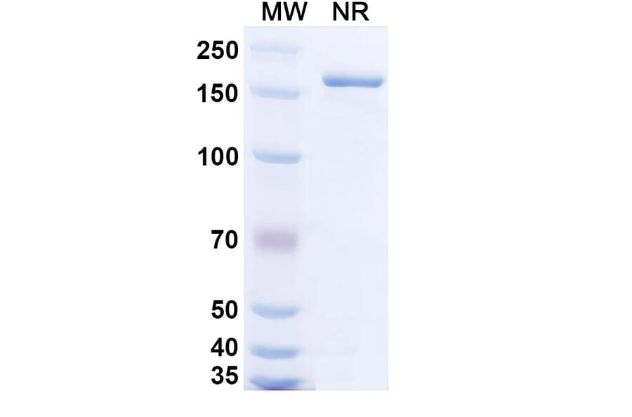 SDS-PAGE - Bempikibart Biosimilar - Anti-CD127 Antibody - BSA and Azide free (A339769) - Antibodies.com