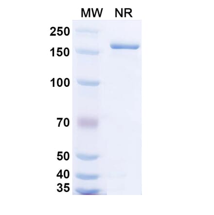 SDS-PAGE - Bempikibart Biosimilar - Anti-CD127 Antibody - BSA and Azide free (A339769) - Antibodies.com