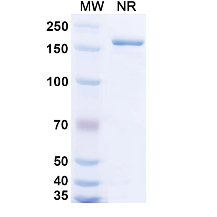 SDS-PAGE - Bempikibart Biosimilar - Anti-CD127 Antibody - BSA and Azide free (A339769) - Antibodies.com