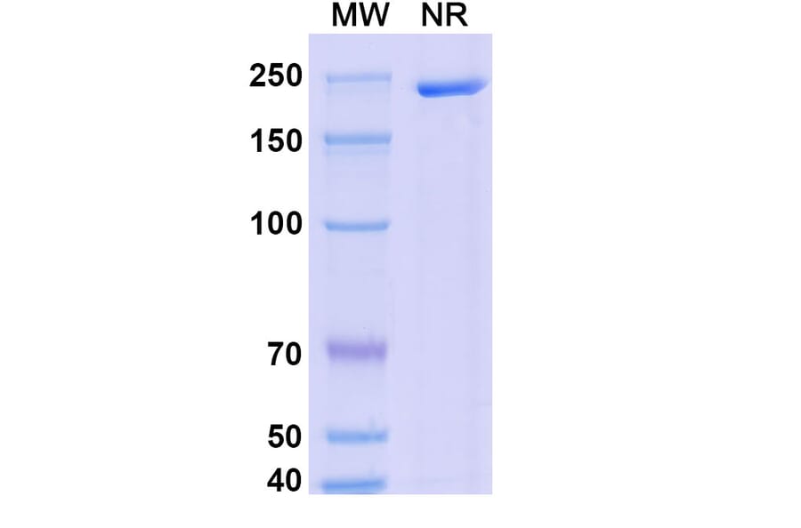 SDS-PAGE - Dalnicastobart Biosimilar - Anti-CD40 Antibody - BSA and Azide free (A339773) - Antibodies.com