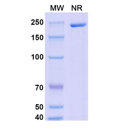 SDS-PAGE - Dalnicastobart Biosimilar - Anti-CD40 Antibody - BSA and Azide free (A339773) - Antibodies.com