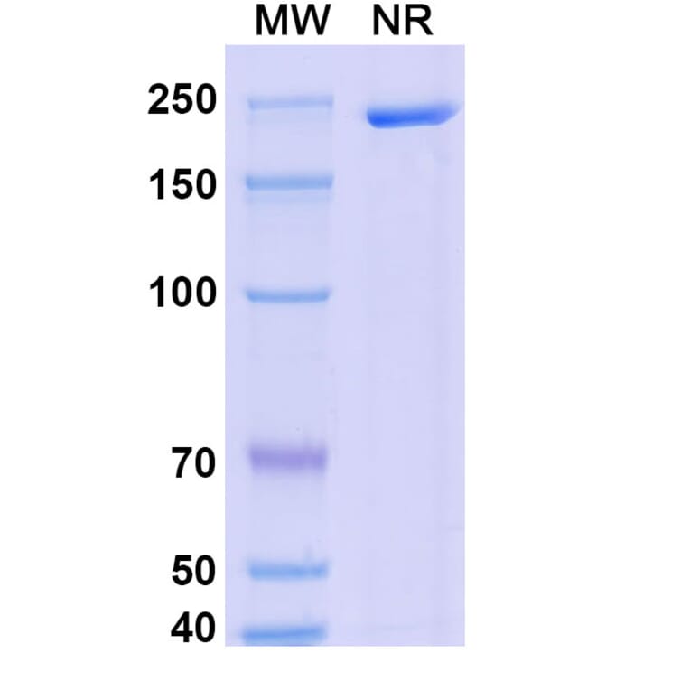 SDS-PAGE - Dalnicastobart Biosimilar - Anti-CD40 Antibody - BSA and Azide free (A339773) - Antibodies.com