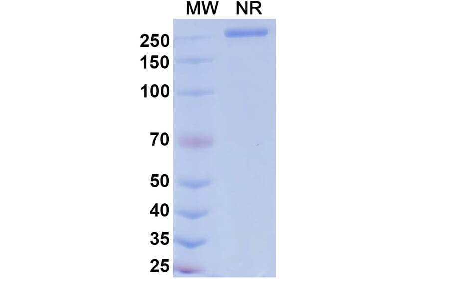 SDS-PAGE - Dalnicastobart Biosimilar - Anti-CD40 Antibody - BSA and Azide free (A339773) - Antibodies.com